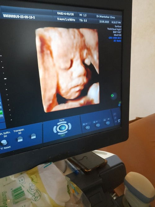 เเม่ก็น้ำหนักพุ่งน้องก็น้ำหนักเกินเกนฑ์เยอะมาก