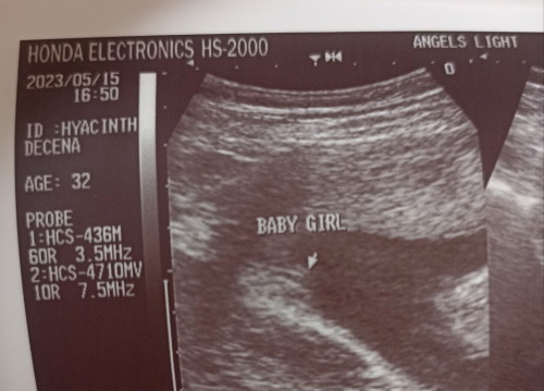 Accurate na po ba ang ultrasound result ng gender ni baby? girl po ung result. 24+1 na po si baby.