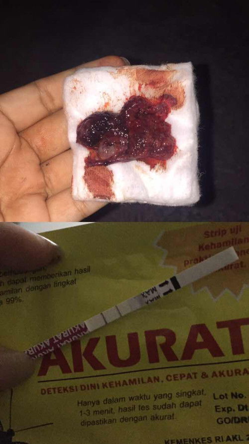 ada yg sama gak bund