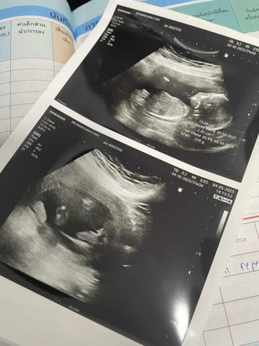 ซาวด์ดูเพศลูกรึยังค่ะ?