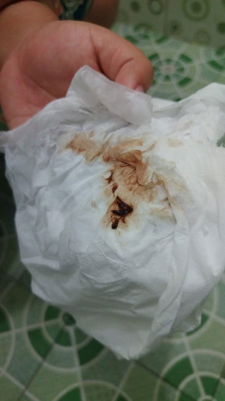 Usia kehamilan 8 Minggu keluar darah