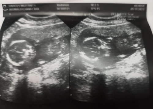 UTZ 17 weeks