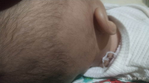 Bagi tipe dong bunda supaya rambut bayi tumbuh dengan lebat🙏
