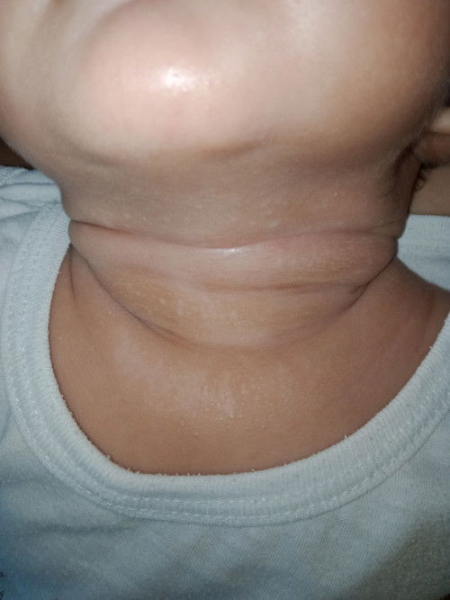 Patulong naman po. An an po b itong nasa leeg ng baby ko?