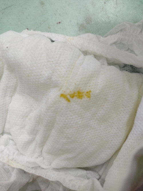 Dilaw sa diaper ni baby