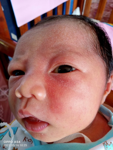 แอบกังวลมากเลยค่ะ