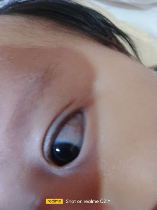 Namumula ang mata ni Baby