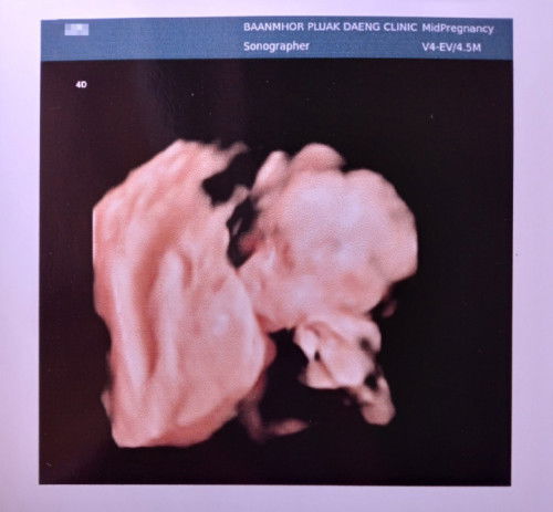 ซาว4มิติทีไรหันข้างให้แม่ตลอดเลยบ้านไหนเป็นบ้างคะ🤣