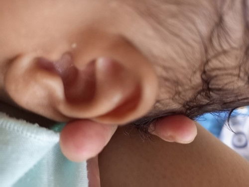 Ini apa ya? Apa obatnya