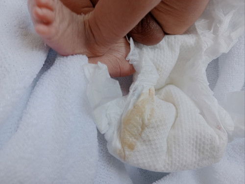 Blood sa Urine ni 5days old Baby boy