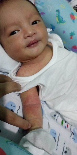Hi mga momsh ano po kaya ito? And ano po kaya pwede ipahid? Wala naman po lagnat ang baby ko. TYIA
