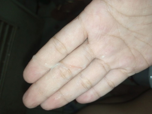 DISCHARGE WITH BLOOD