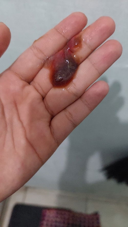 Flek atau lendir darah