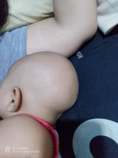 Bentuk kepala bayi