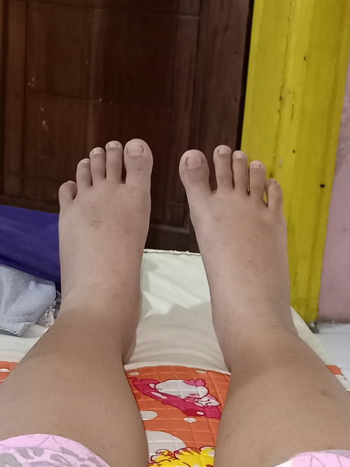 Jahitan lepas sendiri