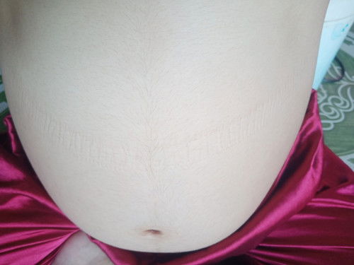 8เดือนเเล้วค่ะเเม่ดิ้นเก่งมากเเทบไม่ได้นอนเลยเเม่บำรุงผักใข่นมเมล็ดอัลม่อนเป็นประจำแม่ๆว่าดีมั้ยคะ