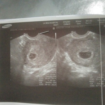 หมอนัดอัลตร้าซาว