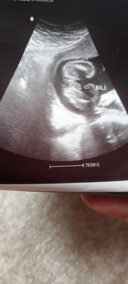 Aks q lang po kung sure na po ba baby boy salamat po sa sasagut