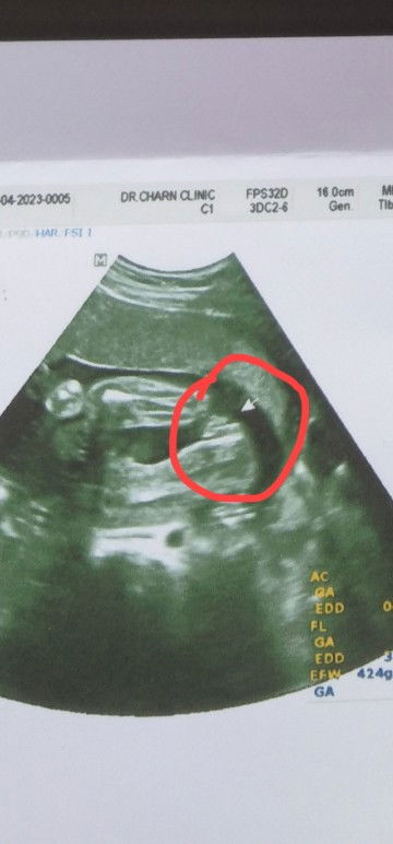 แม่ๆช่วยดูให้หน่อยค่ะ