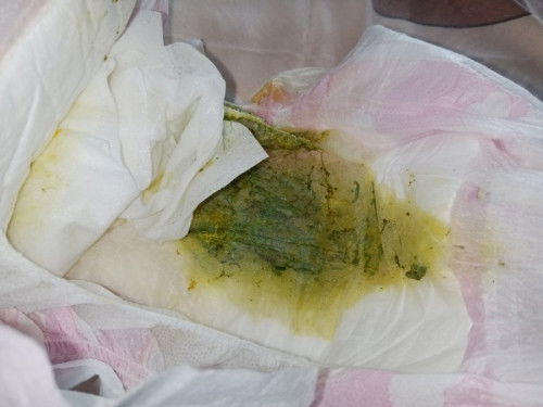 Teething na kaya si baby?