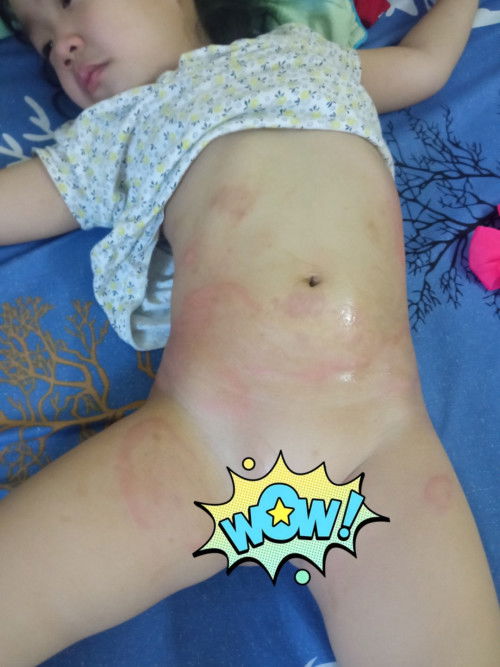 Các mom cho Em hỏi bị vậy là sao ạ.