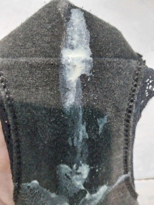 Keputihan berwarna kekuningan