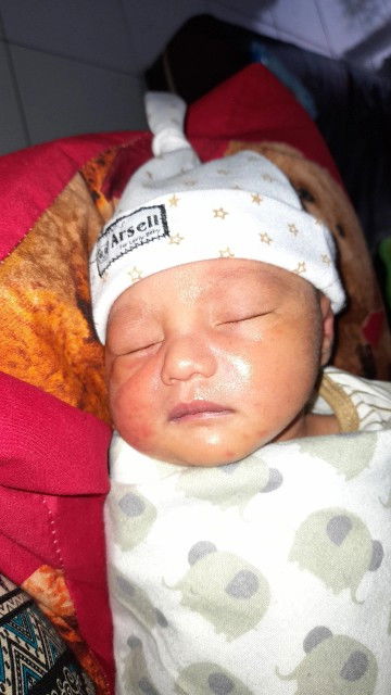 Ruam pada wajah bayi