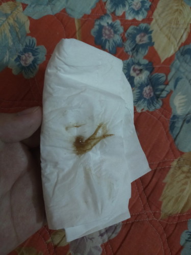 ควรไปหาหมอมั้ยคะ?