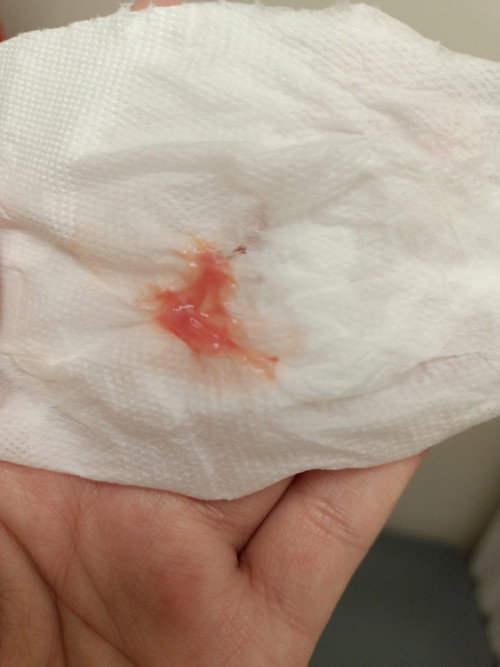Pink Vaginal Discharge
