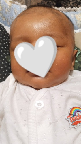 Salam. Nak tanya ada tak ibu² yg ada pengalaman anak dia kena biji milia kat muka?
