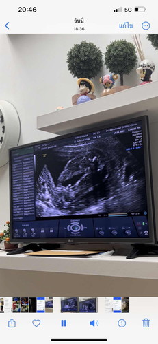 23w ช่วยทายเพศน้องหน่อยค่ะ