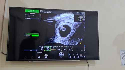 6w3d ปวดท้องน้อยเสี่ยงเป็นอะไรอันตรายไหมคะ