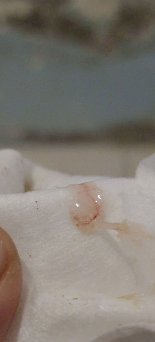 ADA YANG PERNA BATUK BERDAHAK ADA DARAHNYA SEDIKIT GK BUN WAKTU TM 2.