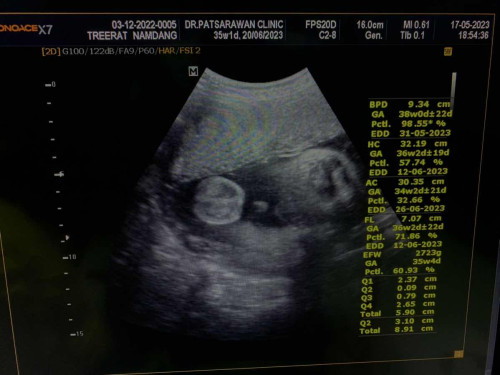 ใครพอจะมีวิธีคลอดง่ายๆบ้างมั้ยคะ🙏🏻