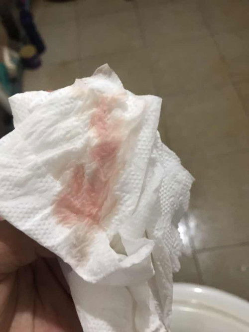 แบบนี้คือใกล้คลอดหรือยัง