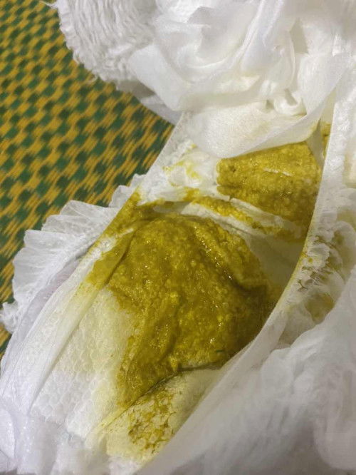 Bé ỉa kiểu này