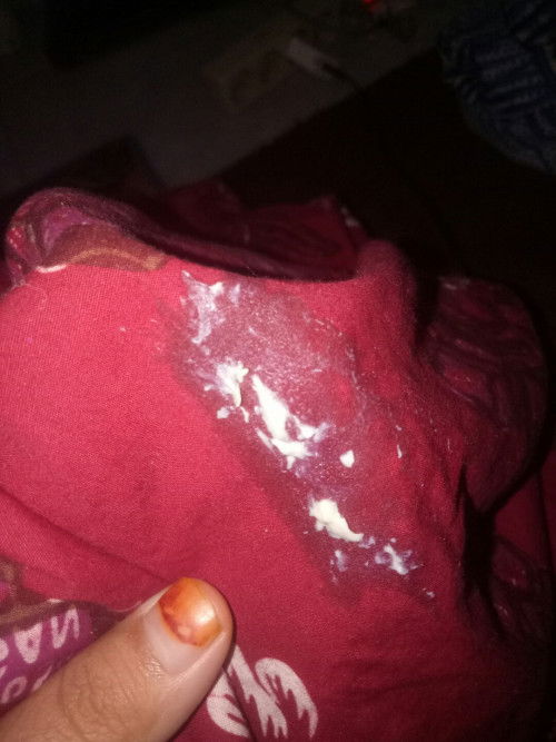 Bun keputihan aku bnyk bgt kaya gitu bahaya gk ya bun takut bgt