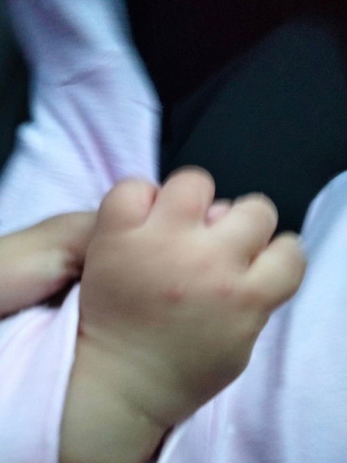 bintik² merah tapi anak normal