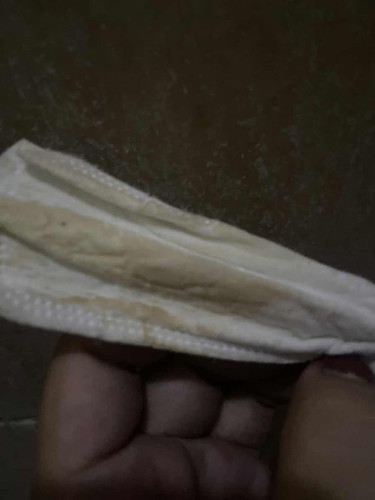 Mga mi normal bato..