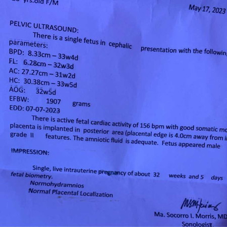 POSTERIOR GRADE 2 meaning po?