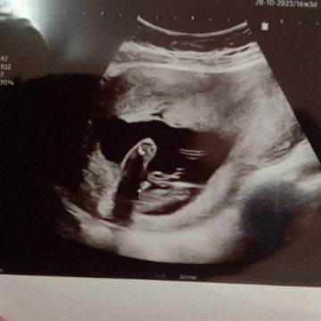 ช่วยดูหน่อยค่ะพี่ๆ