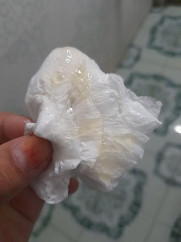 ตอนเช้ามูกมีมูกออก 2ครั้ง พอมาตอนเทียงออกมาเย้อะแบบนี้ต้องโรงบานไหมค่ะ
