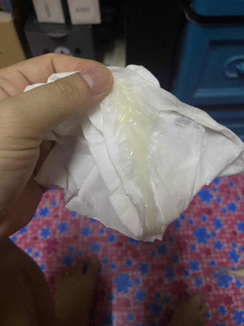 มีมูกใสมา2-3วันเเล้ว เป็นอาการใกล้คลอดหรือป่าวค่ะ ท้องเเรกค่ะ