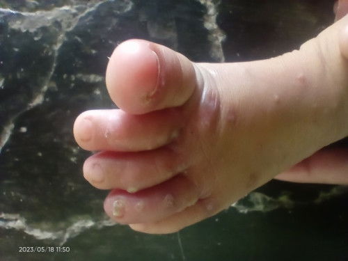 Penyebab dan obatnya apanya apa ya bund