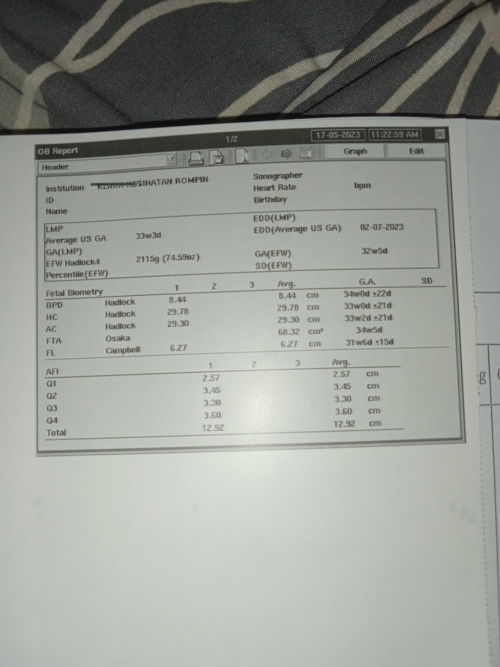 Scan 34 week doktor kata Saiz kaki baby kecil
