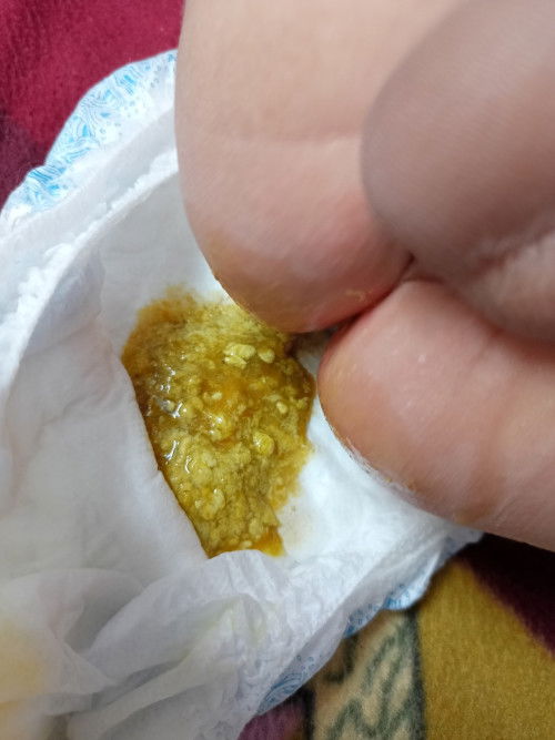 First Time mom!/ PASINTABI SA MGA KUMAKAIN