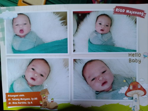 Alhamdulillah sungsang presbo bisa lahiran normal