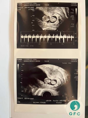 น้อง 9 วีค 5 วัน