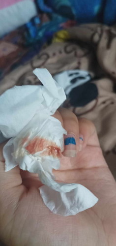 ท้องหรือไม่ท้องคะ