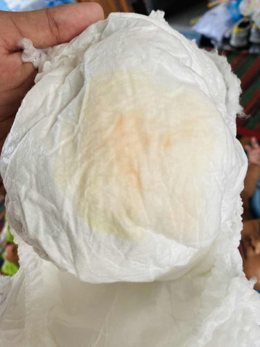 ลูกชายอายุ3เดือนฉี่ผิดปกติ